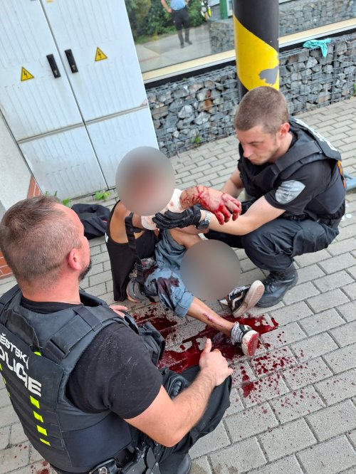 Strážníci zastavili masivní krvácení